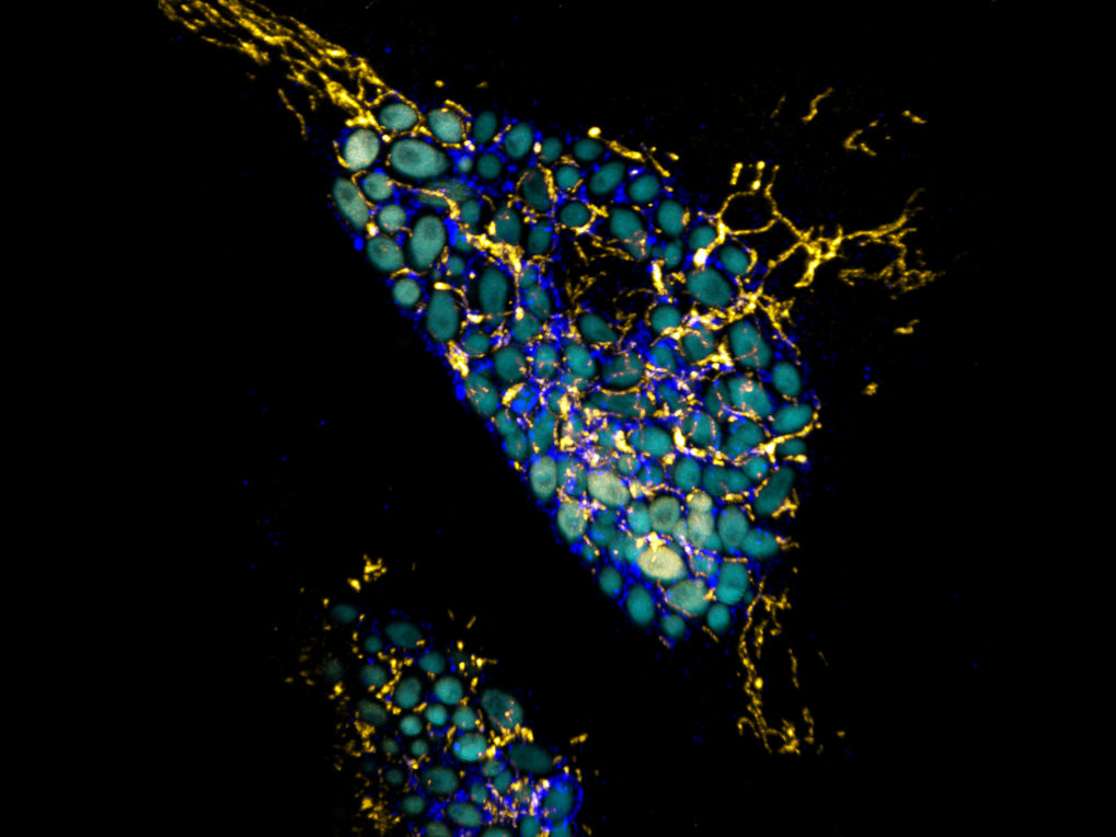 Deciphering lyso-metabolic communication strategies during infection