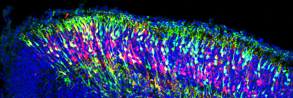 mouse embryonic telencephalon